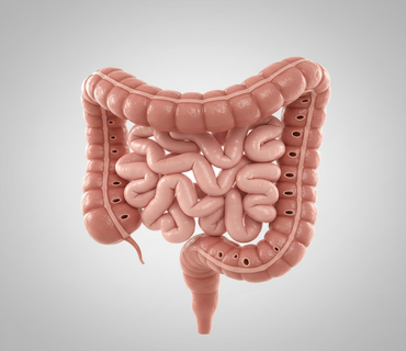 Doença Diverticular do Cólon